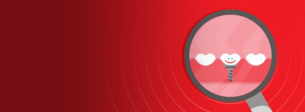 implanturi dentare în gingii