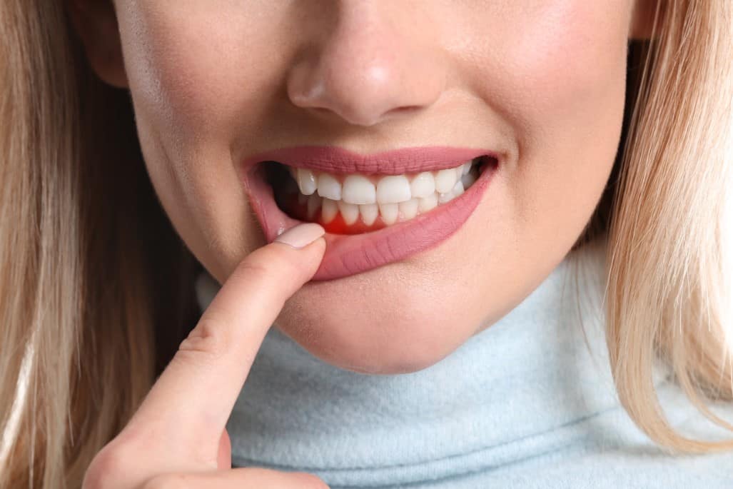 femeie care își arată guma
